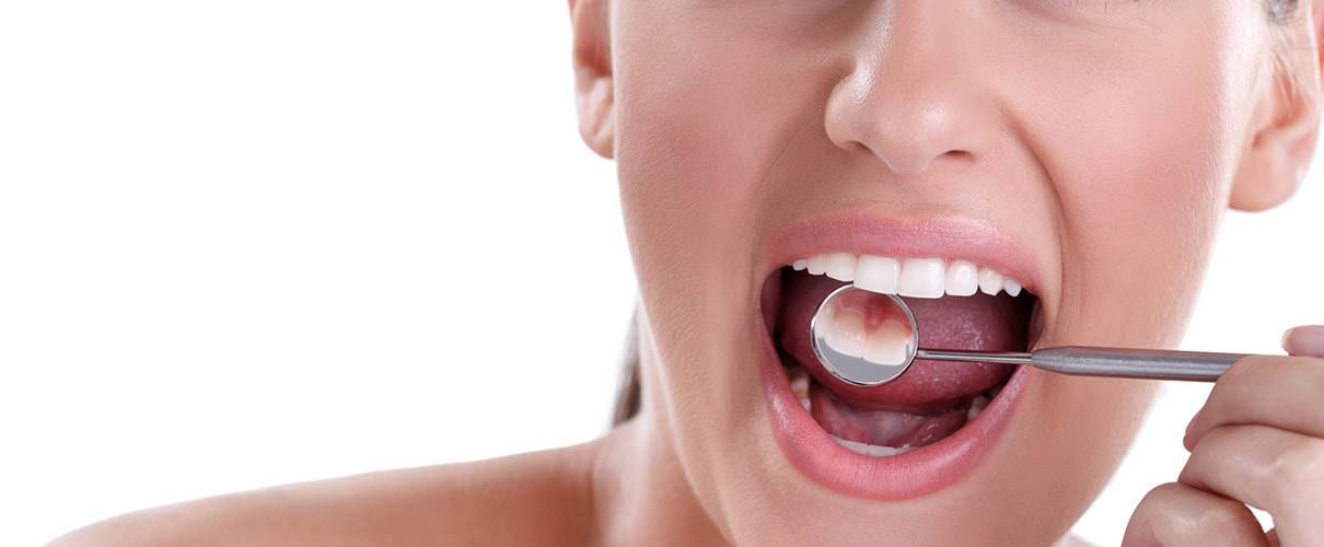 Dental Teeth